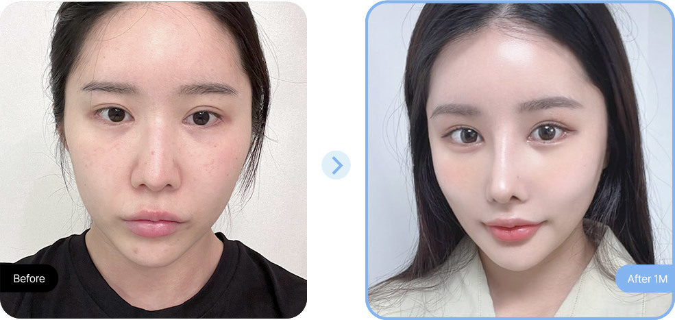 AB plastic surgery