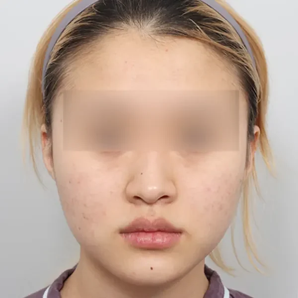 Trước phẫu thuật case 3