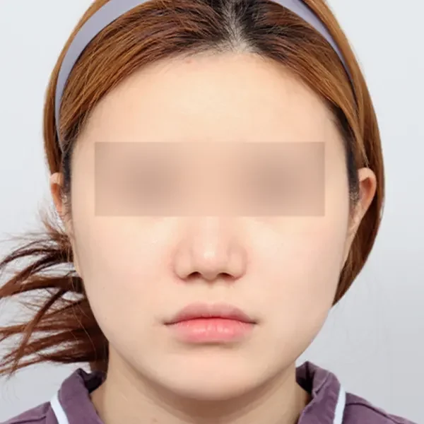 Trước phẫu thuật case 6
