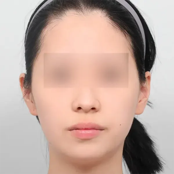 Trước phẫu thuật case 8