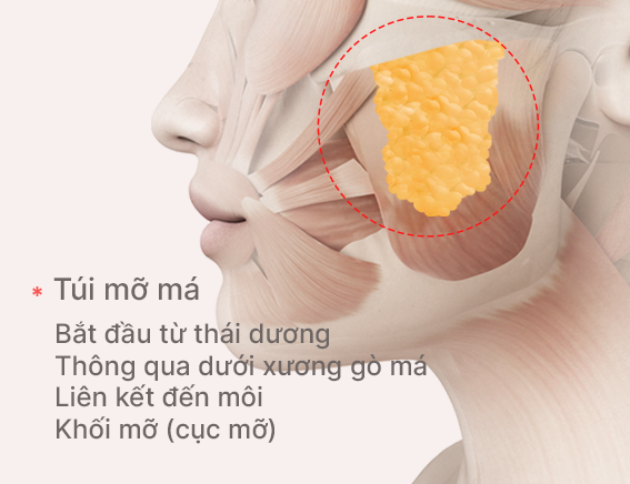 More Contoured: Removal of Buccal Fat