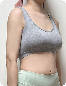 맥미걸 악플콜렉터 Before후 사진