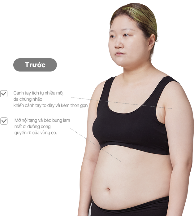 맥미걸 악플콜렉터 바디 수술 전 문제점과 개선점