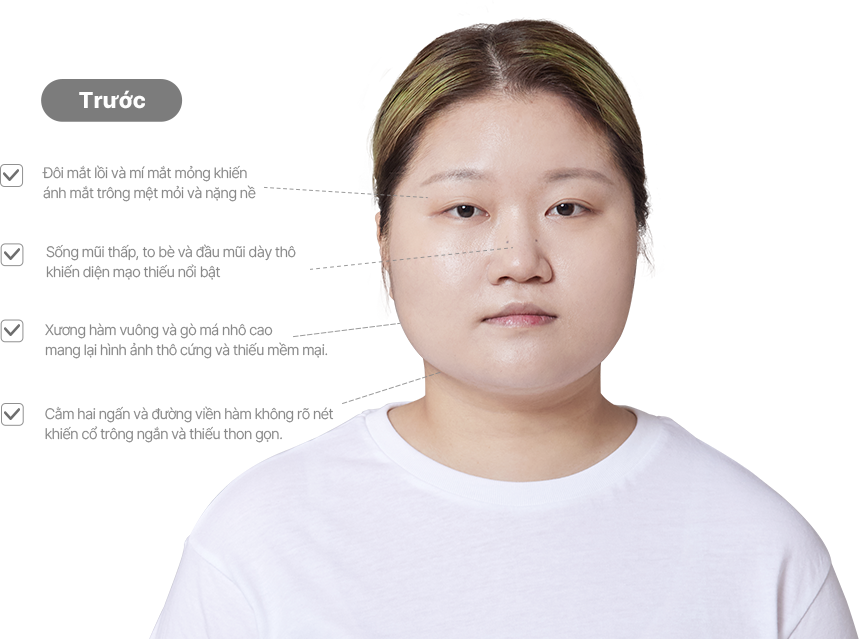 맥미걸 악플콜렉터 얼굴 수술 전 문제점과 개선점