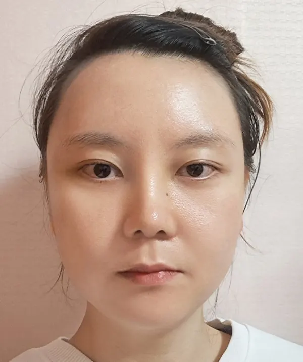 맥미걸 악플콜렉터 Before후 사진