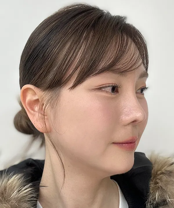 맥미걸 악플콜렉터 Before후 사진