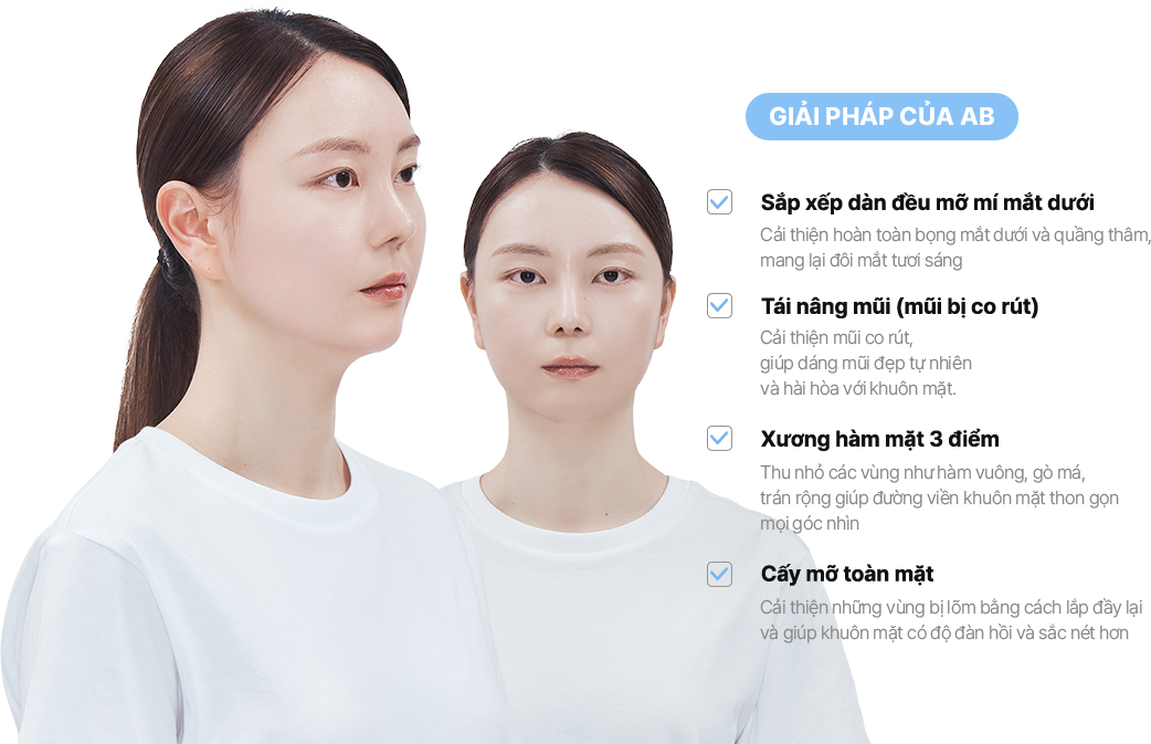 맥미걸 악플콜렉터 얼굴 수술 전 문제점과 개선점