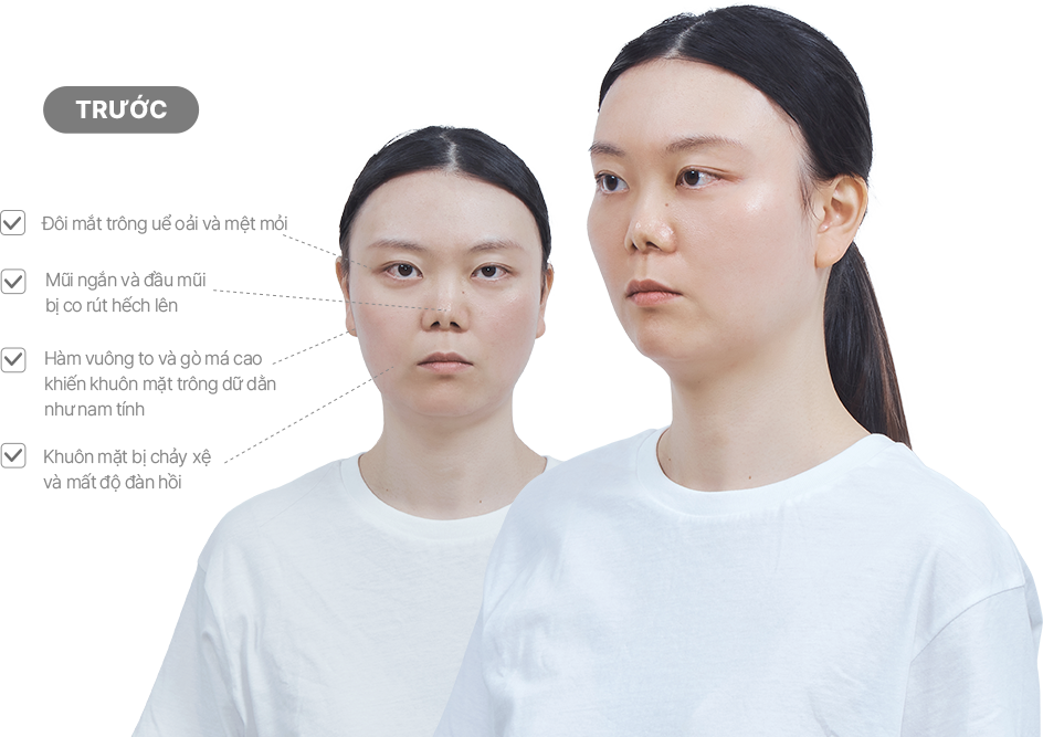 맥미걸 악플콜렉터 얼굴 수술 전 문제점과 개선점