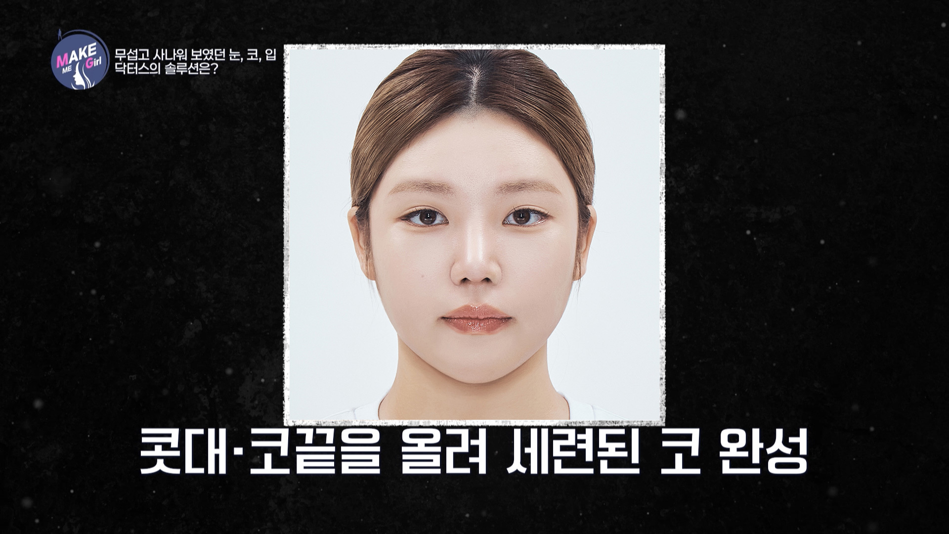 맥미걸 MAKE ME GIRL 수술 후