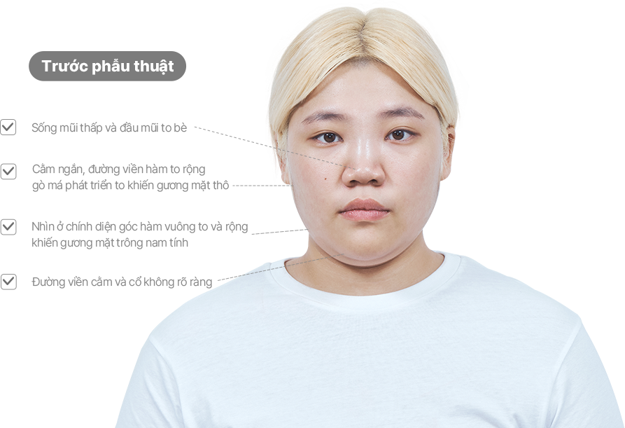 맥미걸 악플콜렉터 얼굴 수술 전 문제점과 개선점