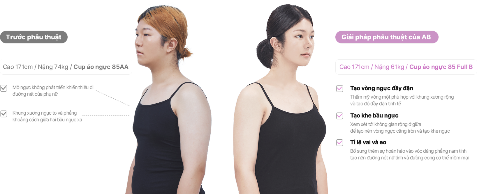맥미걸 악플콜렉터 얼굴 수술 전 문제점과 개선점