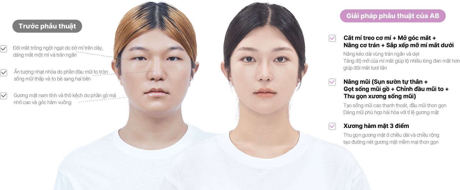 맥미걸 악플콜렉터 얼굴 수술 전 문제점과 개선점