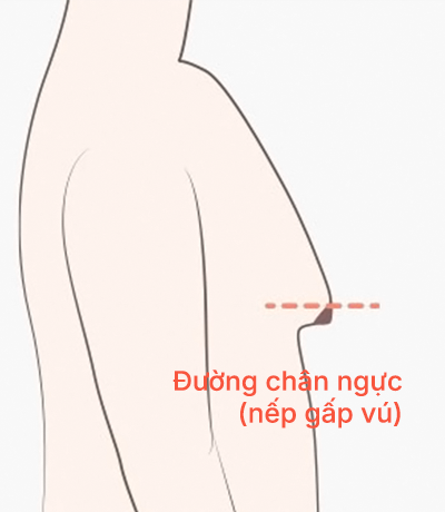 surgery_illust