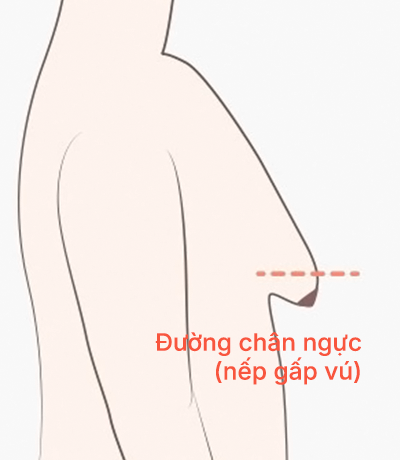 surgery_illust