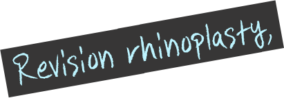 revision-rhinoplasty