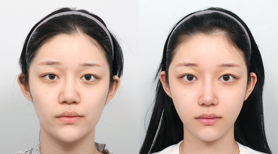 AB Plastic Surgery