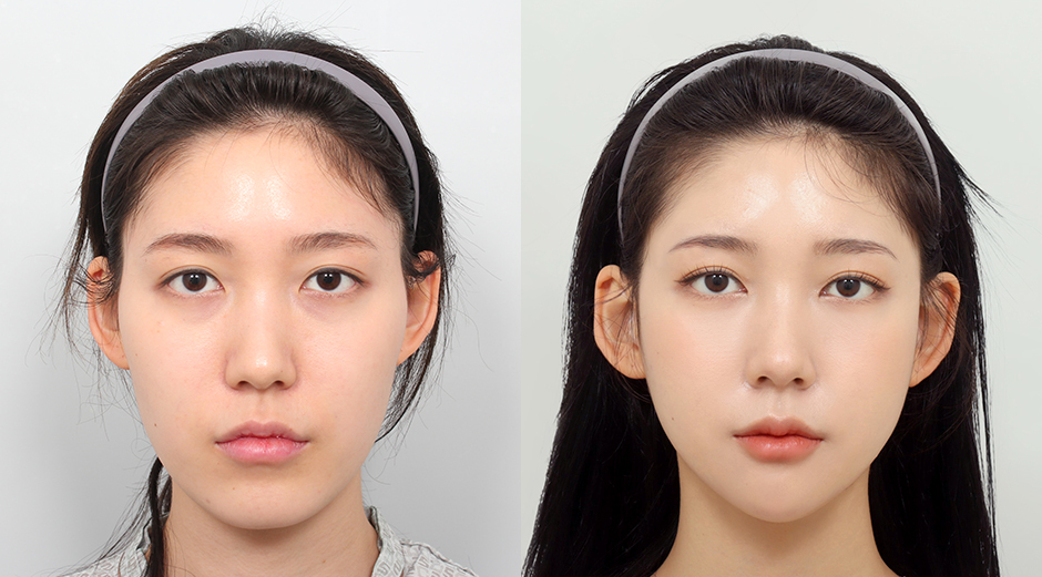 AB Plastic Surgery