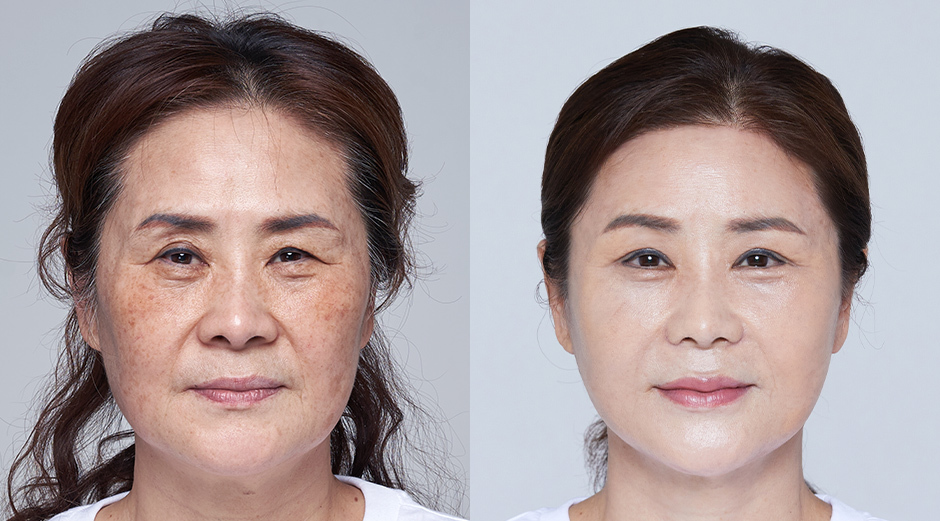 AB Plastic Surgery