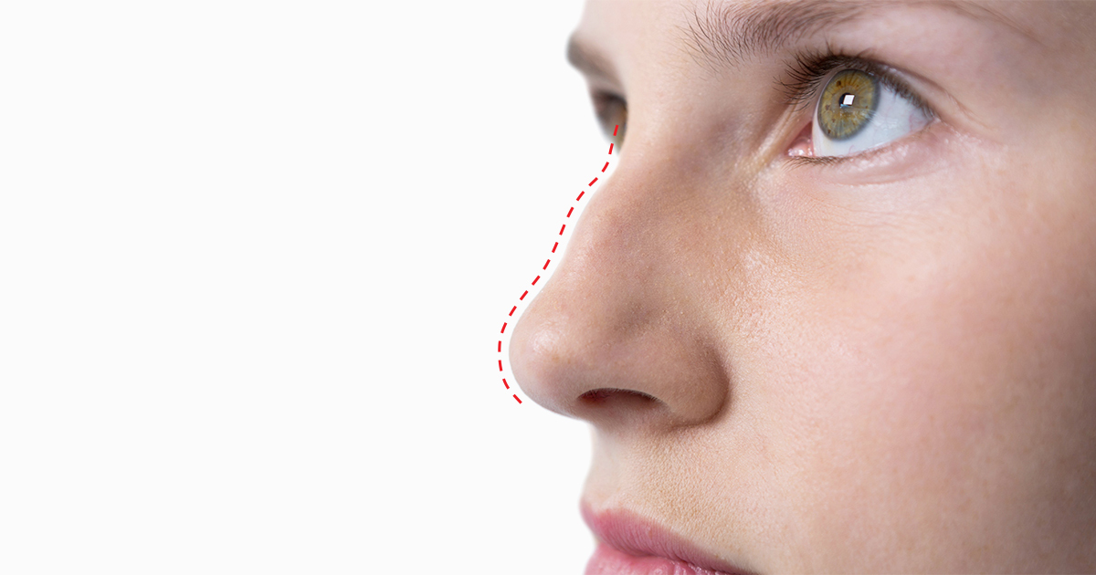 Phẫu thuật thẩm mỹ AB